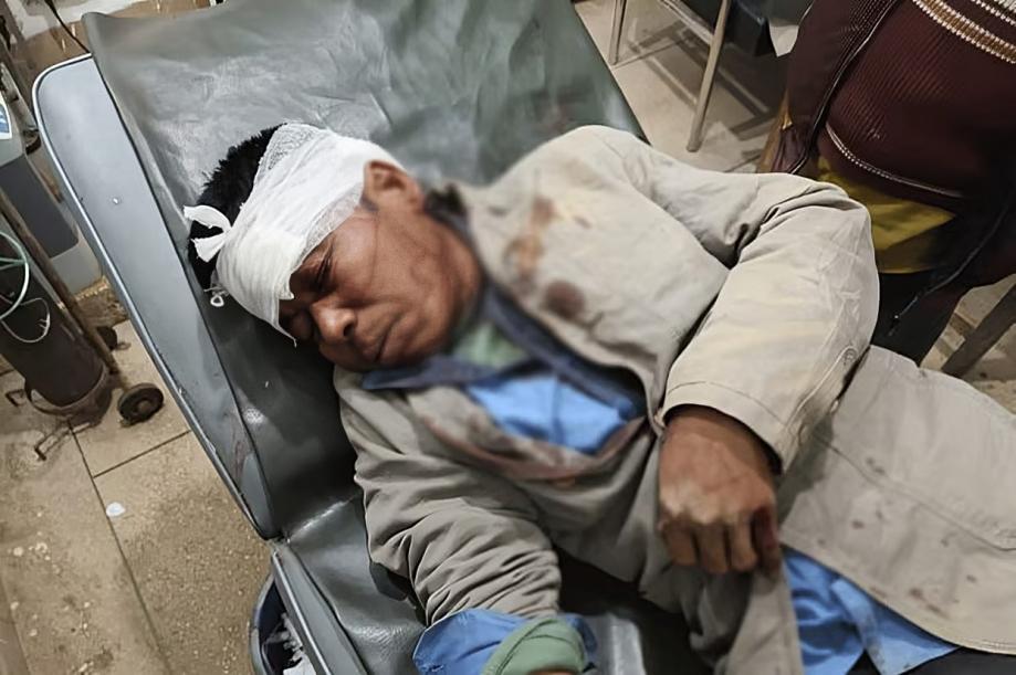 বান্দরবানের আলীকদমে ম্রো সম্প্রদায়ের ওপর সন্ত্রাসী হামলায় ১০ আহত